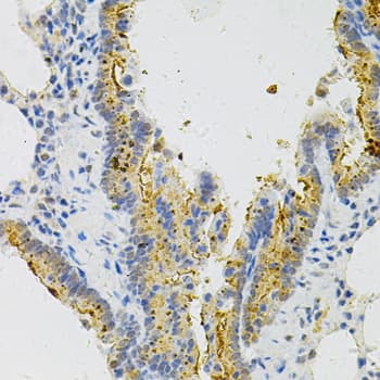 MYD88 Antibody