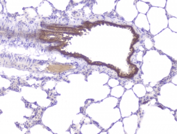 PRKCB / PKC-Beta Antibody