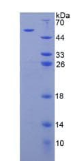 Human ARSB / Arylsulfatase B Protein (Recombinant His, N-Terminal)