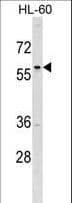 Polyclonal Rabbit anti-Human TFAP2D Antibody (aa308-336, IF, WB)