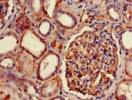 Polyclonal Rabbit anti-Human HLA-B Antibody (Biotin, IHC, WB)