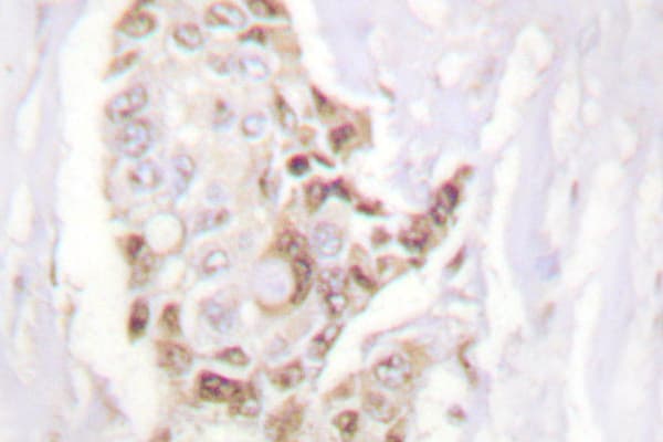 HDAC5 Antibody (Glu1106)