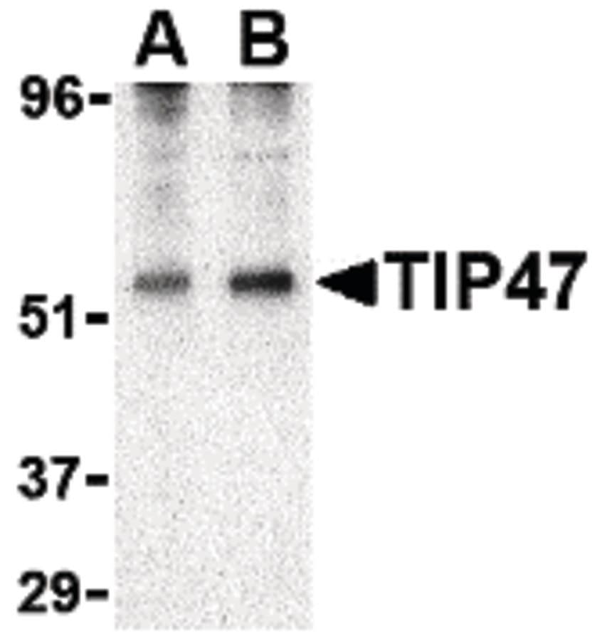 IHC-plus™ Polyclonal Rabbit anti-Human PLIN3 / M6PRBP1 / TIP47 Antibody (IHC, WB)