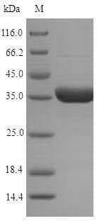 Arabidopsis thaliana AER1 Protein (Recombinant 6His-SUMO, N-terminus)