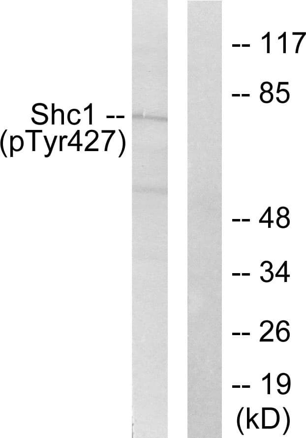 p66 / SHC Antibody (phospho-Tyr427)