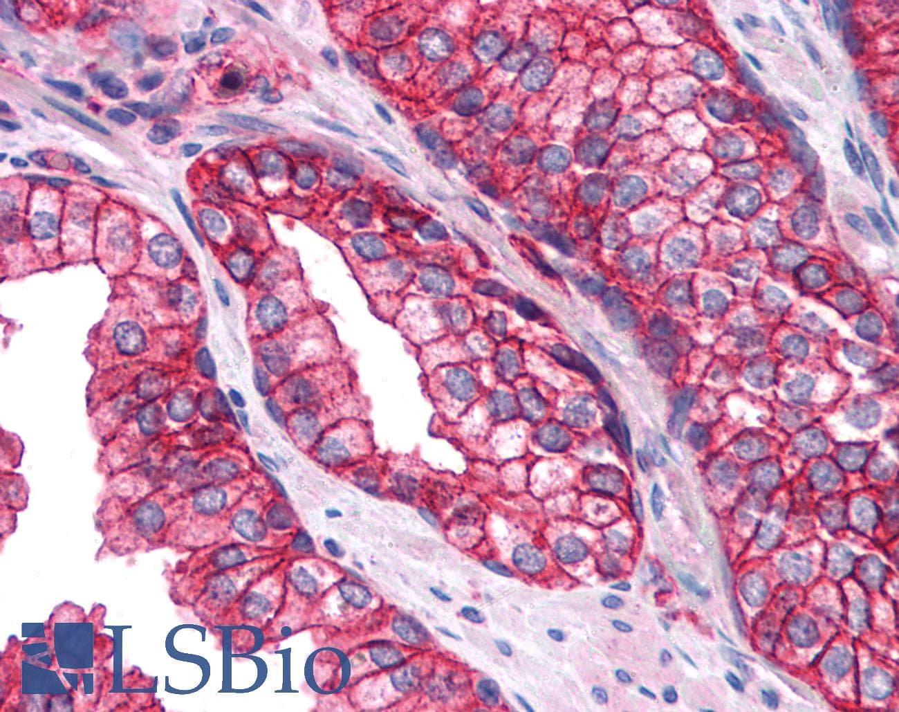 IHC-plus™ Polyclonal Rabbit anti-Human SNAP23 / SNAP-23 Antibody (IHC, WB)