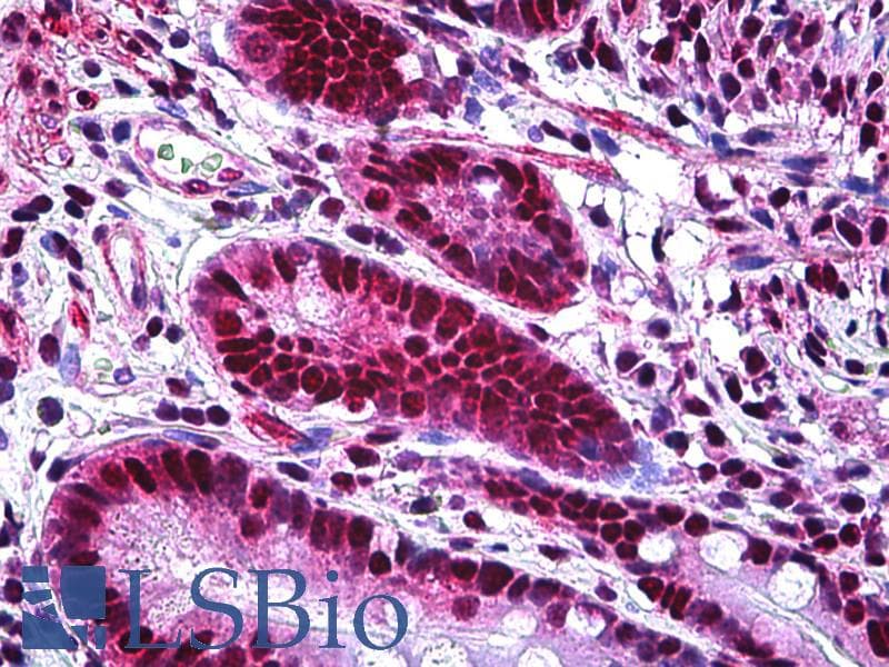 IHC-plus™ XRCC6 / Ku70 Antibody (clone 4C2-1A6)