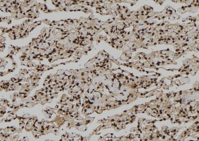 CNOT10 Antibody