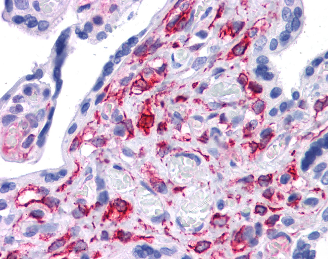 STAT5B Antibody (aa180-229)