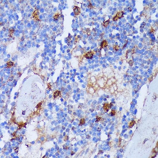 PADI4 / PAD4 Antibody