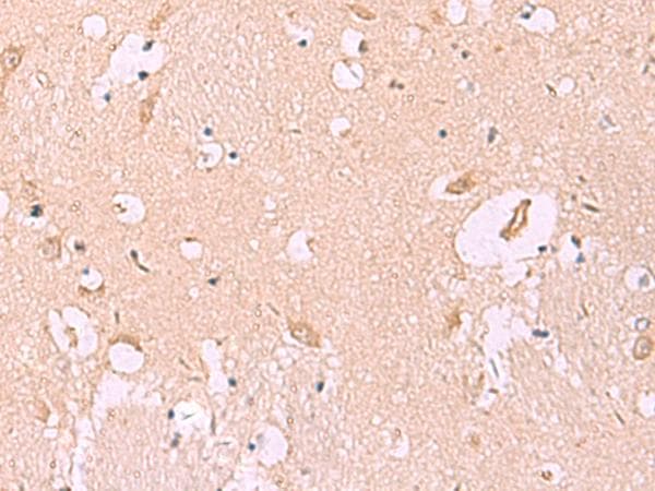 Polyclonal Rabbit anti-Human MKS1 Antibody (IHC, WB)