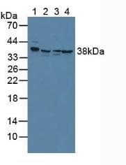 ANXA2 / Annexin A2 Antibody (aa41-182)