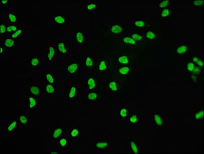 H3F3B Antibody