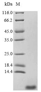 Thrombin-like enzyme gabonase (Bitis gabonica) Protein (Recombinant)