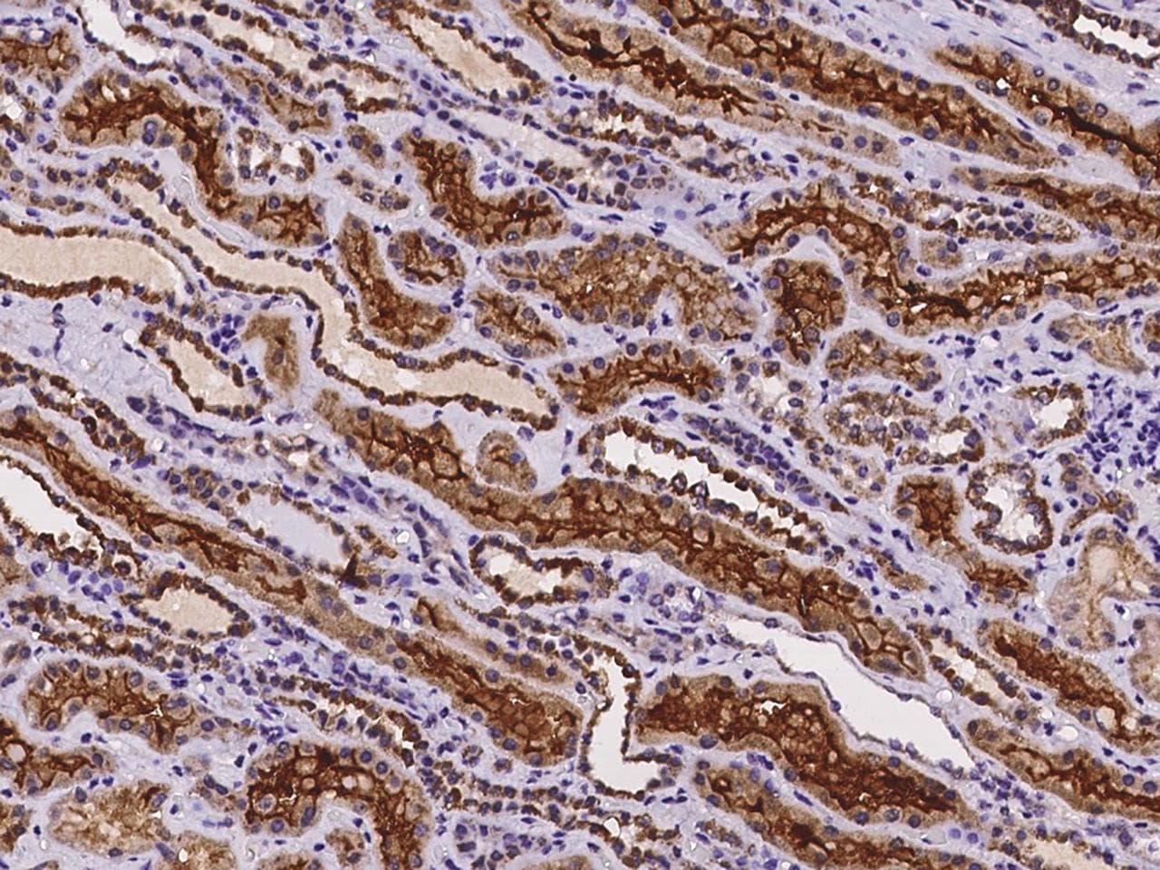 Polyclonal Rabbit anti-Human URAT1 / SLC22A12 Antibody (IHC)