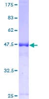 Human UBE2T / HSPC150 Protein (Recombinant GST)