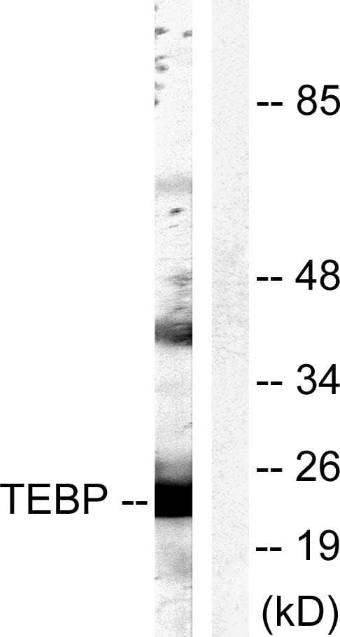 PTGES3 / p23 Antibody (p113)