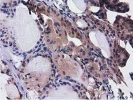 CBWD1 Antibody (clone OTI3A11, Carrier-free)