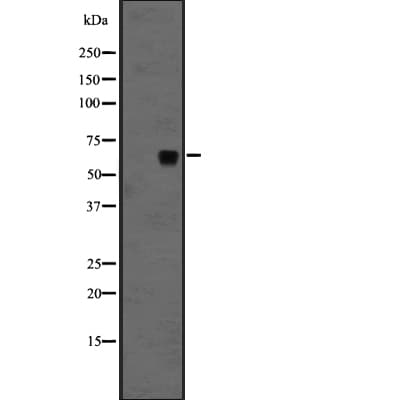 FZD10 / Frizzled 10 Antibody