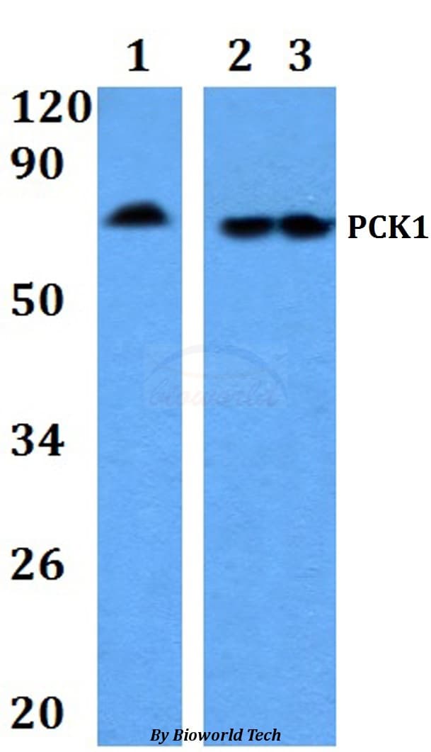 PCK1 Antibody