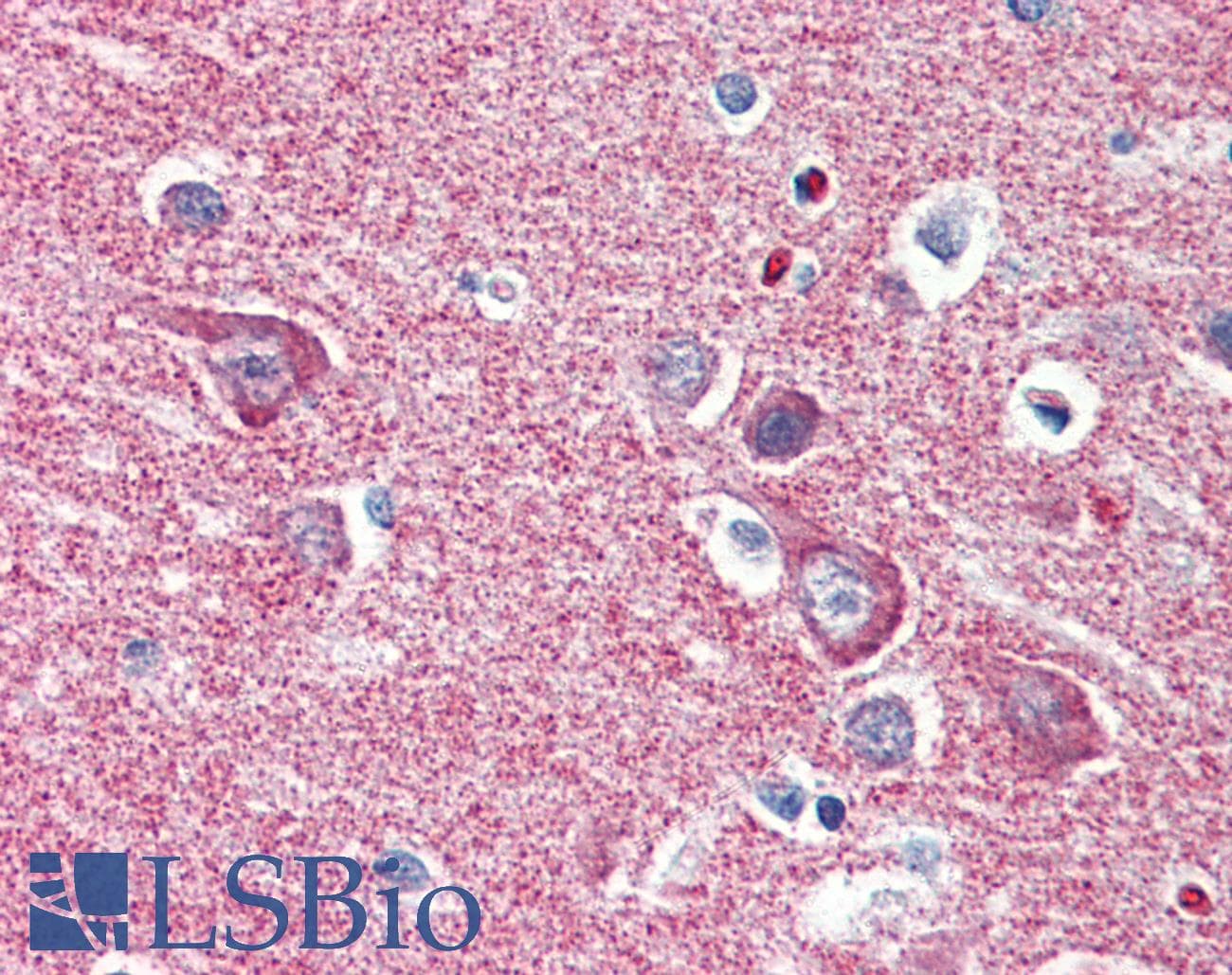 IHC-plus™ HK1 / Hexokinase 1 Antibody (aa1-917, clone 4D7)