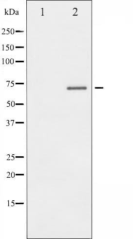 ER Alpha / Estrogen Receptor Antibody (phospho-Ser104)