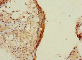 Polyclonal Rabbit anti-Human RAPGEF4 / EPAC2 Antibody (IHC)