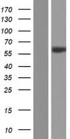 CAMK2B / CaMKII Beta Protein (Over-Expression Lysate Myc-DDK (Flag))