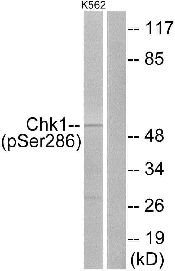 Polyclonal Rabbit anti-Human CHEK1 / CHK1 Antibody (phospho-Ser286, IF, WB)