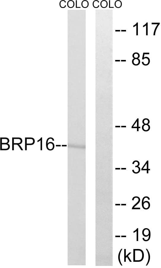 HGH1 / FAM203A Antibody (aa251-300)