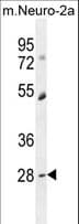 DPCD Antibody (aa96-136)