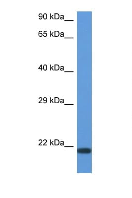 CD27L / CD70 Antibody (aa31-80)