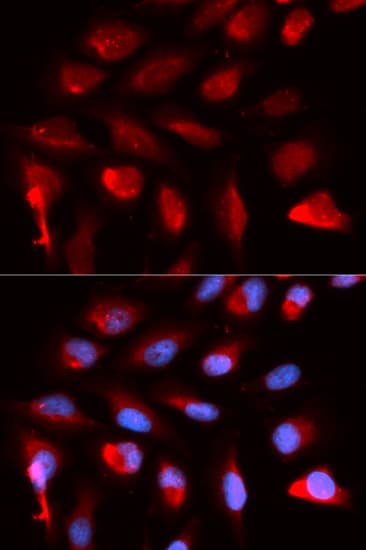 PPARD / PPAR Delta Antibody