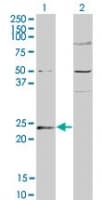 Polyclonal Rabbit anti-Human GUK1 / Guanylate Kinase 1 Antibody (aa128-143, WB)