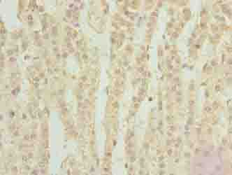 TPRKB Antibody