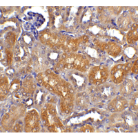 DFFB Antibody