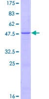 Human IFNA14 / Interferon Alpha 14 Protein (Recombinant GST)