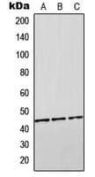 Polyclonal Rabbit anti-Human ORM2 / Orosomucoid 2 Antibody (Internal, WB)