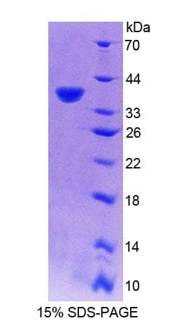 Human RNASEH2A Protein (Recombinant His-T7, N-terminus)
