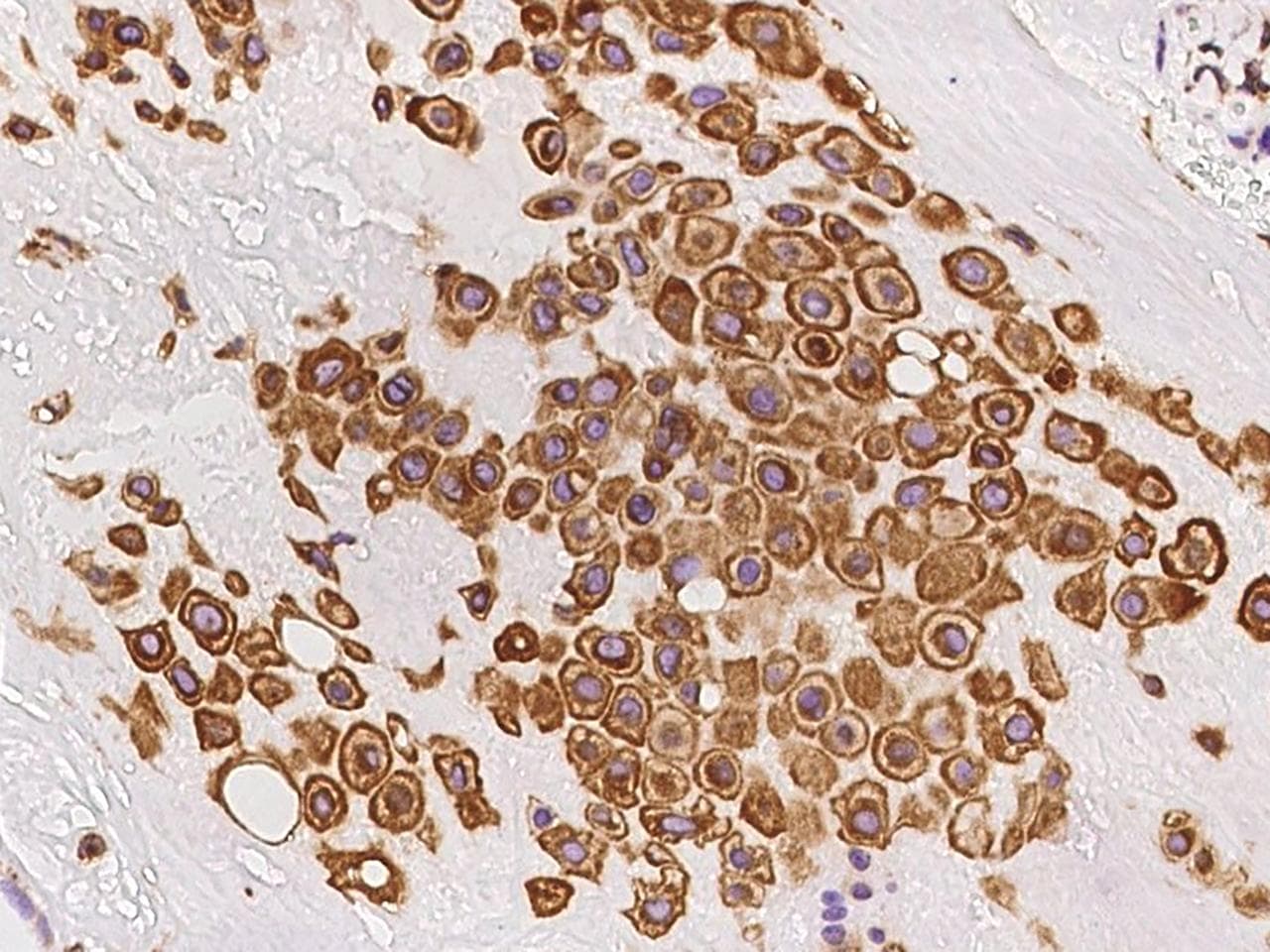 SOAT1 Antibody