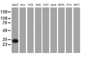 SULT2A1 / Sulfotransferase 2A1 Antibody (clone OTI3E8)