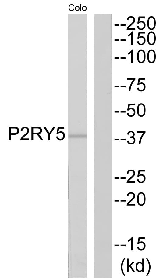Polyclonal Rabbit anti-Human LPAR6 / P2RY5 / P2Y5 Antibody (WB)
