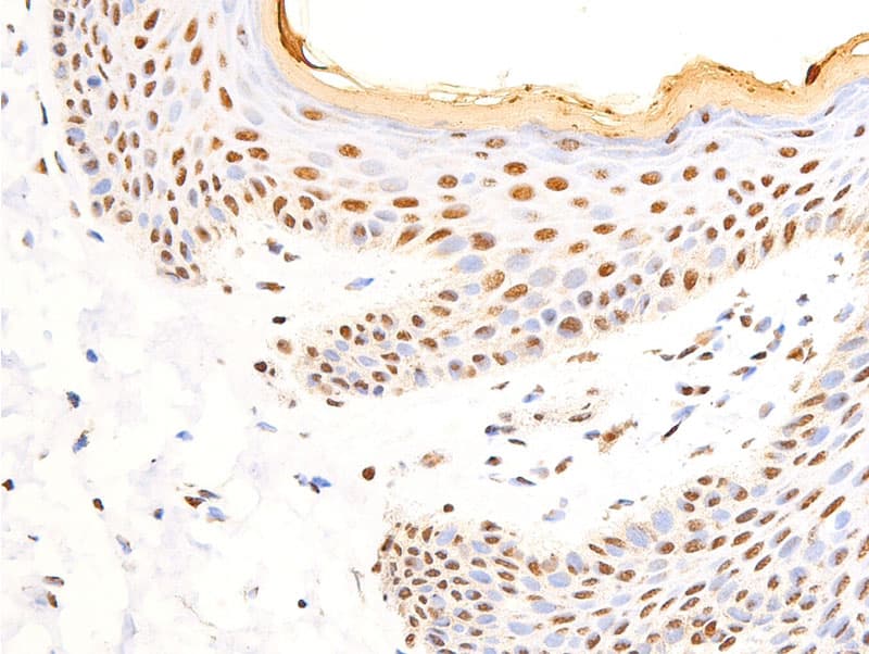 NR3C1/Glucocorticoid Receptor Antibody (phospho-Ser226)
