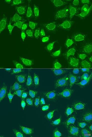 L2HGDH Antibody