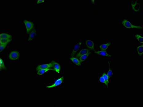 SLC51A / OSTalpha Antibody