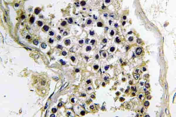 GNAT2 Antibody (Val34)