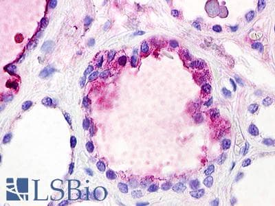 IHC-plus™ Polyclonal Rabbit anti-Human C3AR / C3a Receptor Antibody (C-Terminus, IHC)