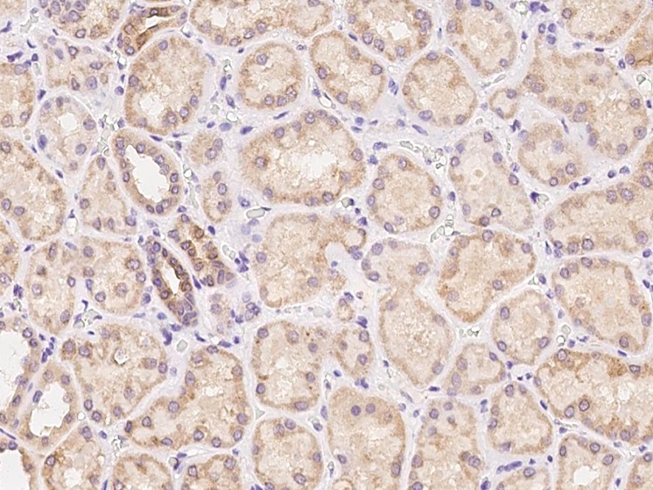 LYPD2 Antibody