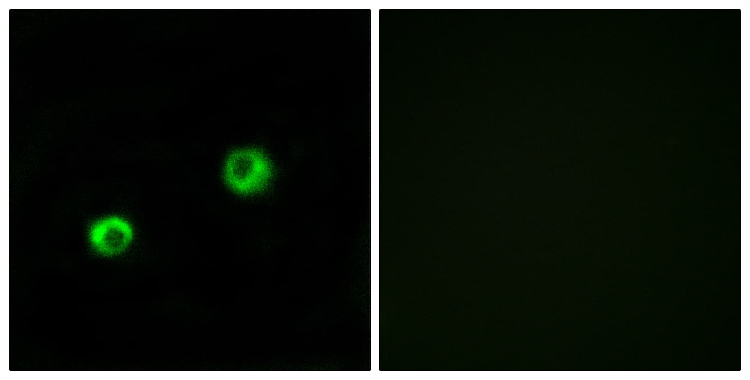 ARSI / Arylsulfatase I Antibody (aa311-360)