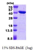 Human CAB39L Protein (Recombinant His)